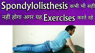 Spondylolisthesis Exercises  Exercises To AVOID For Spondylolisthesis TREATMENT [upl. by Htiel]