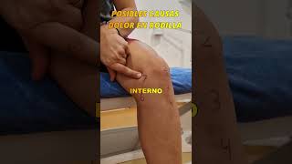 🔷Causas de dolor de RODILLA fisioterapia dolorrodilla [upl. by Ajnek]