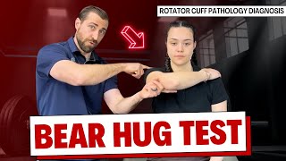 Bear Hug Test for Rotator Cuff Pain Assessment [upl. by Etnahc]