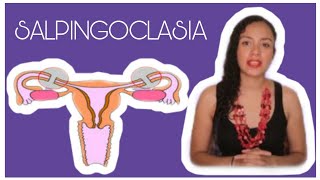 SALPINGOCLASIA ESTERILIZACIÓN FEMENINA OTB CUIDADOS ¿ES REVERSIBLE 🤰 [upl. by Eliak]