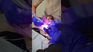 A successful Endodontic treatment Process [upl. by Marcelline]