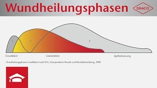 Wundheilungsphasen im Überblick  Exsudationsphase Granulationsphase Epithelisierungsphase [upl. by Artema]