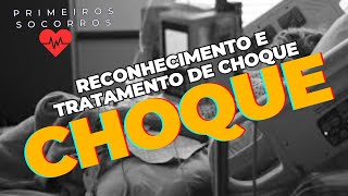 RECONHECIMENTO E TRATAMENTO DE CHOQUE [upl. by Pros]