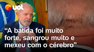 Lula detalha acidente doméstico Bati a cabeça e sangrou muito Estou fazendo exames a cada 3 dias [upl. by Alejna496]