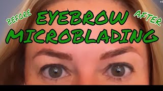 MICROBLADING EYEBROWS BEFORE AND AFTER MICRONEEDLING PERMANENT MAKEUP [upl. by Arelus]