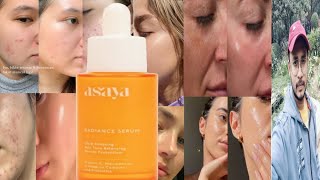 Asaya Radiance Serum  Honest Review [upl. by Nasah]