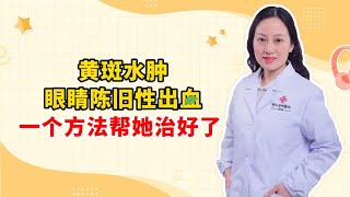 黄斑水肿 眼睛陈旧性出血 一个方法帮她治好了 [upl. by Anaxor847]