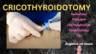 205cricothyroidotomy cricothyrotomy procedure airway emergency stridor [upl. by Ymot]