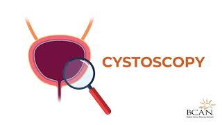 What is a cystoscopy [upl. by Luehrmann]