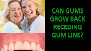 Can Gums Grow Back Receding Gum Line [upl. by Aihsi844]