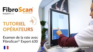 FibroScan® Expert 630  Tutoriel mesure de lélasticité de la rate [upl. by Caz364]