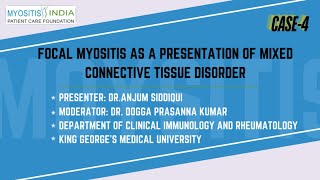 CASE 4 Focal Myositis as a presentation of Mixed Connective Tissue Disorder Dr Anjum Siddiqui [upl. by Acinonrev]