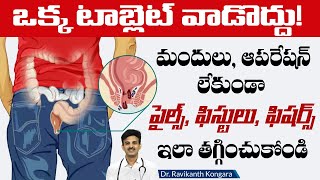 How to Get Relief from Piles Without Operation  Hemorrhoids Symptoms  Dr Ravikanth Kongara [upl. by Godewyn726]