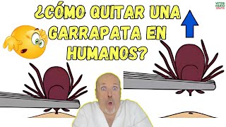 🆘 ¿CÓMO QUITAR UNA GARRAPATA EN HUMANOS Y ELIMINARLA DESPUÉS 🆘 [upl. by Enelyad]