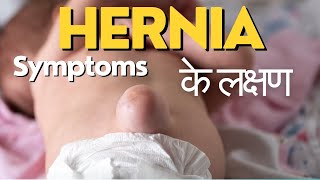 Symptoms of hernia  Hernia ke lakshan  हर्निया के लक्षण  Hernia symptoms in Hindi [upl. by Longawa]