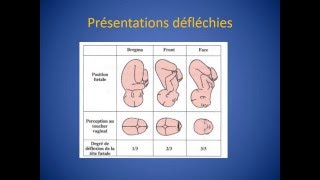 GYNECOLOGIE Présentation du front [upl. by Legnalos]