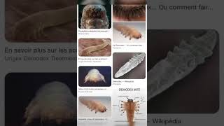 Poux de cils  demodex [upl. by Reedy]