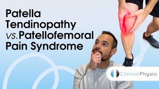 Patella Tendinopathy vs Patellofemoral Pain Syndrome  Expert Physio Guide [upl. by Acker468]