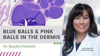 Blue Balls and Pink Balls in the Dermis  July 2020 \ Dermpath Happy Hour [upl. by Ridglee407]