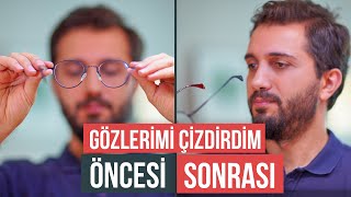 LAZER GÖZ AMELİYATI OLDUM  Öncesi Sonrası ve Tüm Yaşadıklarım [upl. by Helsell]