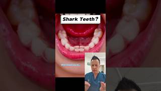 Dealing With Bottom Front Teeth Coming Out Crooked shorts dentalhealth sharkteeth dentist [upl. by Ativad]