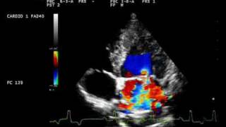 endocardite mitralica con controllo mitral endocarditis dog [upl. by Vish]