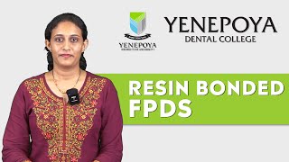 Resin Bonded Fixed Partial Dentures  Prosthodontics  Yenepoya Dental College [upl. by Rizas]