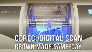 How Dental Crowns are Made with CEREC® [upl. by Clayborne356]