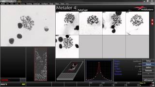 AutoCapt  Automated Image Acquisition with Metafer [upl. by Adnileb]