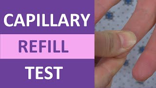 Capillary Refill Time Test Normal vs Abnormal  Nursing Clinical Skills [upl. by Eceinaj]