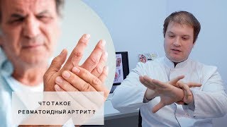 РЕВМАТОИДНЫЙ АРТРИТ l Что это такое l Симптомы Пути лечения [upl. by Dayir350]