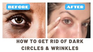 Skincare for Dark Circles Wrinkles under Eyes I Treatment for undereye Milia and Puffy Eyes [upl. by Thecla465]