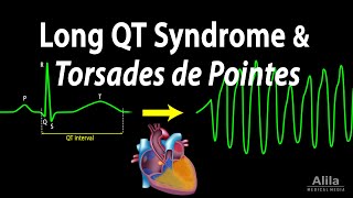 Long QT Syndrome and Torsades de Pointes Animation [upl. by Nolla]