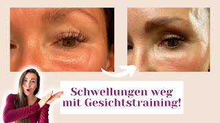 Geschwollene Augen wegbekommen Erfahrungsbericht [upl. by Floss]