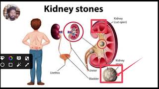 Medical Topic Videos Disease Treatment Hindi [upl. by Nosmirc105]