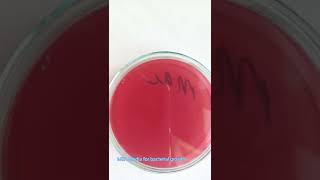 Bacterial culture  Bacterial growth on Media  Microbiology  Culture sensitivity test [upl. by Rramaj]