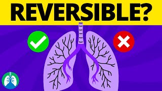 Reversible Airway Obstruction TMC Practice Question  Respiratory Therapy Zone [upl. by Lenra]