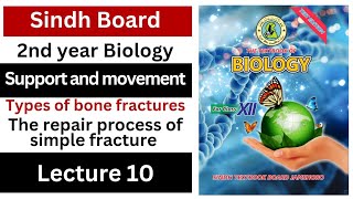 types of bone fractures  the repair process of simple fracture  support and movement  12 biology [upl. by Narda215]