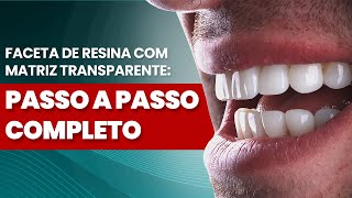 FACETA DE RESINA COM MATRIZ TRANSPARENTE PASSO A PASSO COMPLETO  Mylene e Renato [upl. by Nadbus]