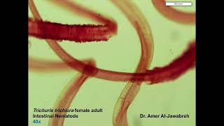 Trichuris trichiura Adult Female Intestinal Nematode [upl. by Andeee]