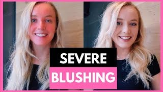 MY PERSONAL EXPERIENCE WITH BLUSHING TO MY FELLOW BLUSHERS [upl. by Schweitzer]