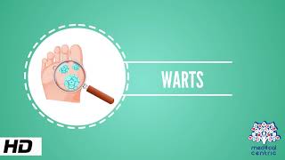 Wart Causes Signs and Symptoms Causes Diagnosis and Treatment [upl. by Akived]