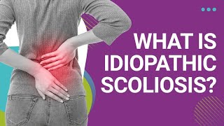 What is Idiopathic Scoliosis [upl. by Eugor]