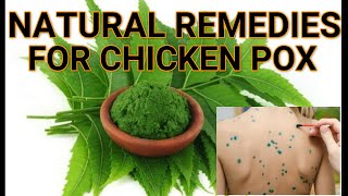 Chicken Pox Natural Remedies [upl. by Sirromed]