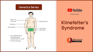 Klinefelters Syndrome Explained Genetics Characteristics and Complications [upl. by Matty]