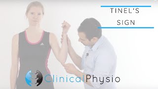 Tinels Test for Cubital Tunnel Syndrome  Clinical Physio [upl. by Osborne221]