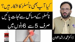 Tonsillitis SymptomsCauses And Treatment In Urdu  Gale Ke Tonsils k ilaj [upl. by Brandais71]