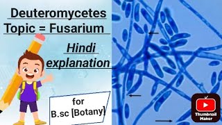 Topic  Fusarium  for Bsc Botany [upl. by Temple]