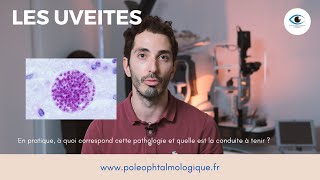 Uvéite antérieure intermédiaire et postérieure Pole Ophtalmologique [upl. by Howlan]