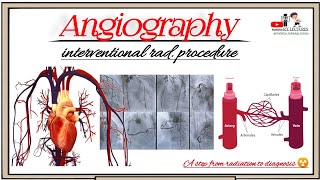 Angiography ArteriographyVenography Angiography radiological examination Angiography test [upl. by Chiquita]